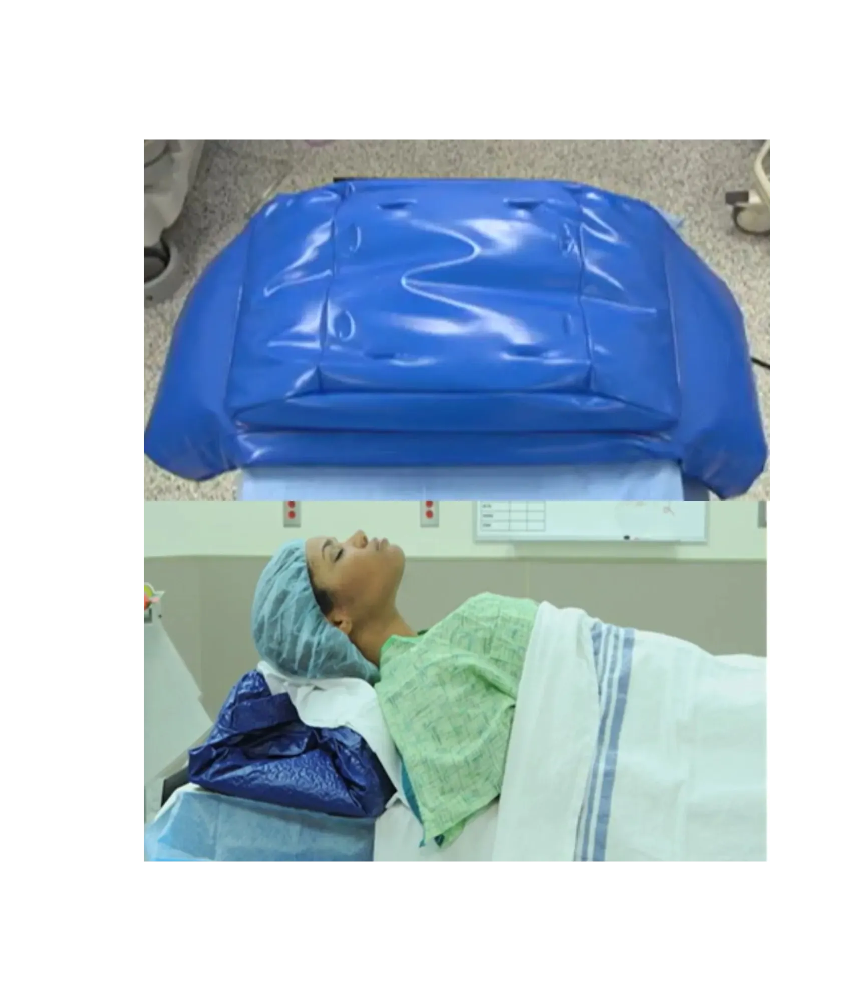 Blue Flex C Pose surgical positioner in use on a patient